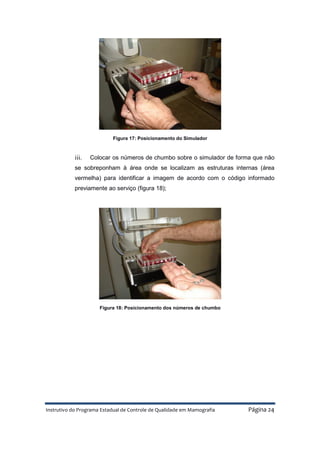 Instrutivo do Programa Estadual de Controle de Qualidade em Mamografia Página 24
Figura 17: Posicionamento do Simulador
iii. Colocar os números de chumbo sobre o simulador de forma que não
se sobreponham à área onde se localizam as estruturas internas (área
vermelha) para identificar a imagem de acordo com o código informado
previamente ao serviço (figura 18);
Figura 18: Posicionamento dos números de chumbo
 