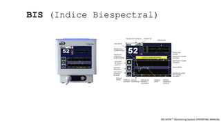 BIS (Indice Biespectral)
BIS VISTA™ Monitoring System OPERATING MANUAL
 