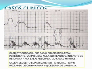 CASOS CLINICOS




 CARDIOTOCOGRAFIA: FCF BASAL BRADICARDIA FETAL
 PERSISTENTE. VARIABILIDAD NULA. NO REACTIVO. INTENOTS DE
 RETORNAR A FCF BASAL ADECUADA. AU CADA 3 MINUTOS.
 CAUSA: DECUBITO SUPINO MATERNO – EPIDURAL – DPPNI
 PROLAPSO DE CU (RN APGAR 1-5) CESAREA DE URGENCIA.
 