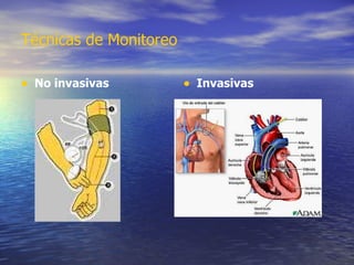 Técnicas de Monitoreo  No invasivas Invasivas 