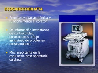 ECOCARDIOGRAFIA Permite evaluar anatómica y funcionalmente al corazón. Da información instantánea de contractilidad, cortocircuitos o flujo sanguíneo de problemas extracardiacos. Muy importante en la evaluación post operatoria cardíaca . 