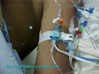 Eje flebostático y calibración 