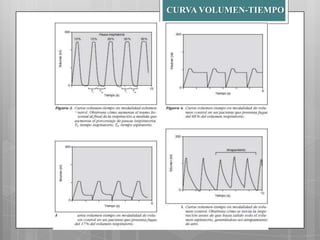 CURVA VOLUMEN-TIEMPO

 