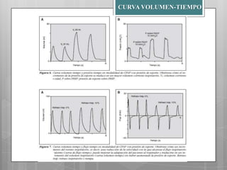 CURVA VOLUMEN-TIEMPO

 