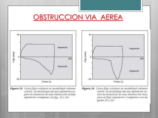 OBSTRUCCION VIA AEREA

 