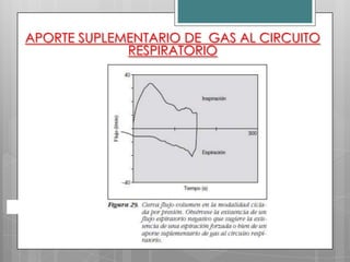 APORTE SUPLEMENTARIO DE GAS AL CIRCUITO
RESPIRATORIO

 