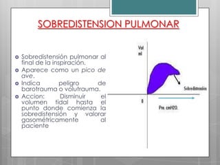 SOBREDISTENSION PULMONAR






Sobredistensión pulmonar al
final de la inspiración.
Aparece como un pico de
ave.
Indica
peligro
de
barotrauma o volutrauma.
Accion:
Disminuir
el
volumen tidal hasta el
punto donde comienza la
sobredistensión y valorar
gasométricamente
al
paciente

 