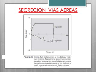 SECRECION VIAS AEREAS

 