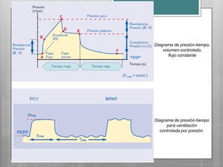 Diagrama de presión-tiempo,
volumen-controlado,
flujo constante

Diagrama de presión-tiempo
para ventilación
controlada por presión.

 