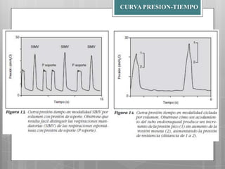 CURVA PRESION-TIEMPO

 