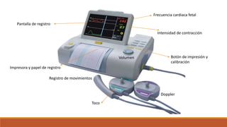 Doppler
Toco
Registro de movimientos
Botón de impresión y
calibración
Volumen
Impresora y papel de registro
Pantalla de registro
Frecuencia cardiaca fetal
Intensidad de contracción
 