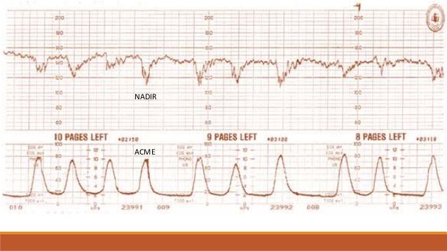 Monitoreo electronico fetal intraparto pdf to word