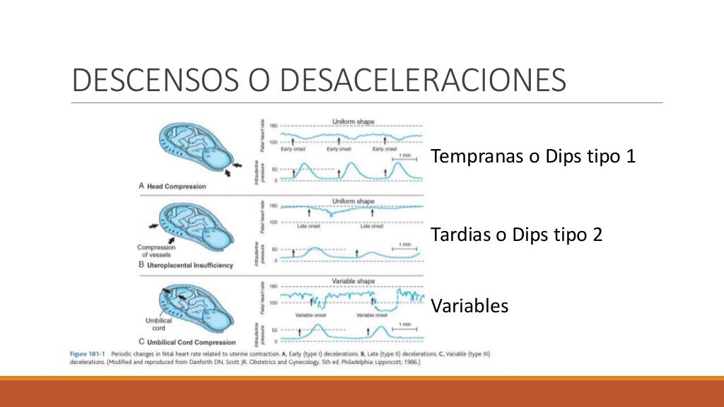 Monitoreo Fetal 2016