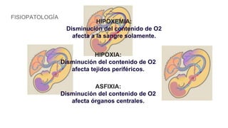 FISIOPATOLOGÍA
HIPOXEMIA:
Disminución del contenido de O2
afecta a la sangre solamente.
HIPOXIA:
Disminución del contenido de O2
afecta tejidos periféricos.
ASFIXIA:
Disminución del contenido de O2
afecta órganos centrales.
 
