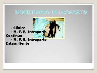 MONITOREO INTRAPARTO
- Clínico
- M. F. E. Intraparto
Contínuo
- M. F. E. Intraparto
Intermitente

 