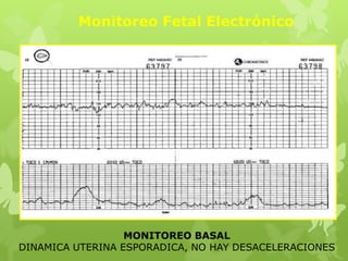 Monitoreo Fetal Electrónico




                  MONITOREO BASAL
DINAMICA UTERINA ESPORADICA, NO HAY DESACELERACIONES
 