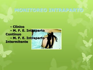 MONITOREO INTRAPARTO


   - Clínico
   - M. F. E. Intraparto
Contínuo
   - M. F. E. Intraparto
Intermitente
 