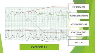 BASES DEL MONITOREO FETAL ELECTRÓNICO.pptx