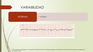 Monitorización Fetal Electrónica: Interpretación y Manejo Clínico | PPTX