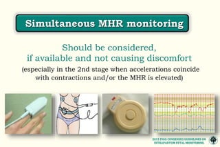 MONITOREO FETAL INTRAPARTO CONSENSO FIGO 2015.pptx