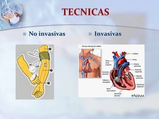 TECNICAS
 No invasivas  Invasivas
 