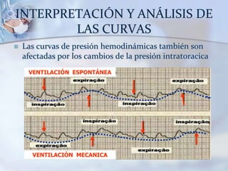 INTERPRETACIÓN Y ANÁLISIS DE
LAS CURVAS
 Las curvas de presión hemodinámicas también son
afectadas por los cambios de la presión intratoracica
VENTILACIÓN ESPONTÁNEA
VENTILACIÓN MECANICA
 