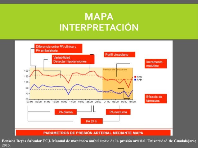 mapa monitoreo ambulatorio de la presion arterial pdf Monitoreo Ambulatorio De Presion Arterial Mapa mapa monitoreo ambulatorio de la presion arterial pdf mapa monitoreo ambulatorio de la presion arterial pdf Monitoreo Ambulatorio De Presion Arterial Mapa mapa monitoreo ambulatorio de la presion arterial pdf
