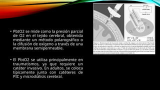 Pbto2 Monitor Monitoreo Multimodal en Neuro-críticos.pptx