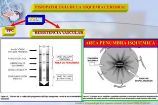 FISIOPATOLOGIA DE LA  ISQUEMIA CEREBRALFSC  PPCRESISTENCIA VASCULARAREA PENUMBRA ISQUEMICAAREA DE PENUMBRACastillo J. Fisiopatología de la isquemia cerebral. Rev Neurol 2000;30:459-464.