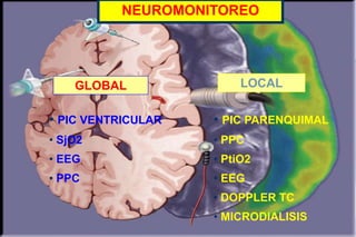 NEUROMONITOREOLOCALGLOBALPIC PARENQUIMAL