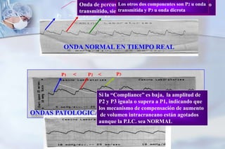 Monitorización de la HTEGeneralidades - ClínicaCefaleaVómitos en chorros Edema de papilaPosturas anómalasAlteración  pupilarDisminución Estado de concienciaDisminución en el puntaje de la Escala de Coma de GlasgowTardíos