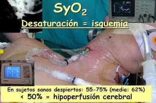FUNDAMENTOS TERAPEUTICOSOPORTUNIDAD