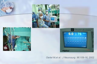 Herramienta terapéutica (drenaje LCR)