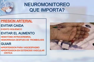 NEUROMONITOREO
QUE IMPORTA?
PRESION ARTERIAL
EVITAR CAIDA
EVENTO ISQUEMICO
EVITAR EL AUMENTO
HEMATOMA INTRACEREBRAL
HEMORRAGIA DESPUES DE TROMBOLISIS
GUIAR
HIPERTENSION PARA VASOESPASMO
HIPERTENSION EN ESTENOSIS VASCULAR
CRITICA
 