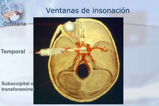 Ventanas de insonación
Temporal
Orbitaria
Suboccipital o
transforaminal
 