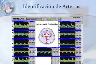 Identificación de Arterias
 