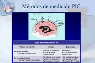 Métodos de medición PIC
 