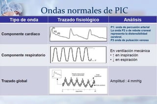 Ondas normales de PIC
P1: onda de percusión arterial
La onda P2 o de rebote craneal
representa la distensibilidad
cerebral.
P3 onda de pulsación venosa
 