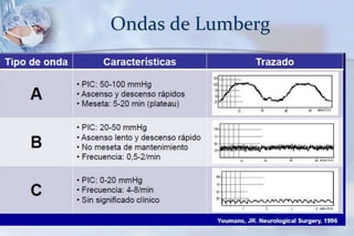 Ondas de Lumberg
 