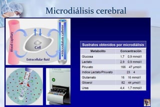 Microdiálisis cerebral
 