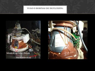 YUGO O BOBINAS DE DEFLEXIÓN:
 