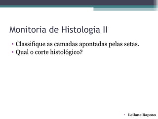 Monitoria de Histologia II
• Classifique as camadas apontadas pelas setas.
• Qual o corte histológico?




                                         • Leilane Raposo
 