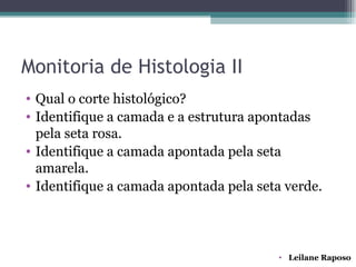 Monitoria de Histologia II
• Qual o corte histológico?
• Identifique a camada e a estrutura apontadas
  pela seta rosa.
• Identifique a camada apontada pela seta
  amarela.
• Identifique a camada apontada pela seta verde.




                                        • Leilane Raposo
 