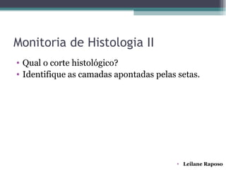 Monitoria de Histologia II
• Qual o corte histológico?
• Identifique as camadas apontadas pelas setas.




                                         • Leilane Raposo
 
