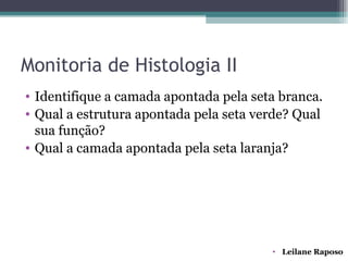 Monitoria de Histologia II
• Identifique a camada apontada pela seta branca.
• Qual a estrutura apontada pela seta verde? Qual
  sua função?
• Qual a camada apontada pela seta laranja?




                                        • Leilane Raposo
 