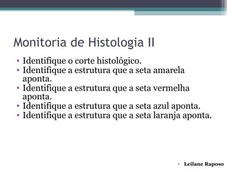Monitoria de Histologia II
• Identifique o corte histológico.
• Identifique a estrutura que a seta amarela
  aponta.
• Identifique a estrutura que a seta vermelha
  aponta.
• Identifique a estrutura que a seta azul aponta.
• Identifique a estrutura que a seta laranja aponta.




                                          • Leilane Raposo
 