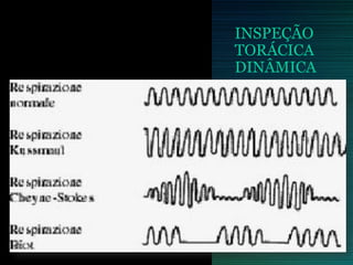 INSPEÇÃO
TORÁCICA
DINÂMICA
 