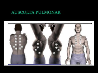 AUSCULTA PULMONAR
 