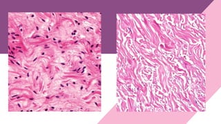 Comprehensive Overview of Connective Tissue Cells and Fibers in ...