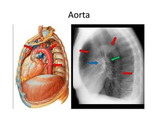 Aorta
 